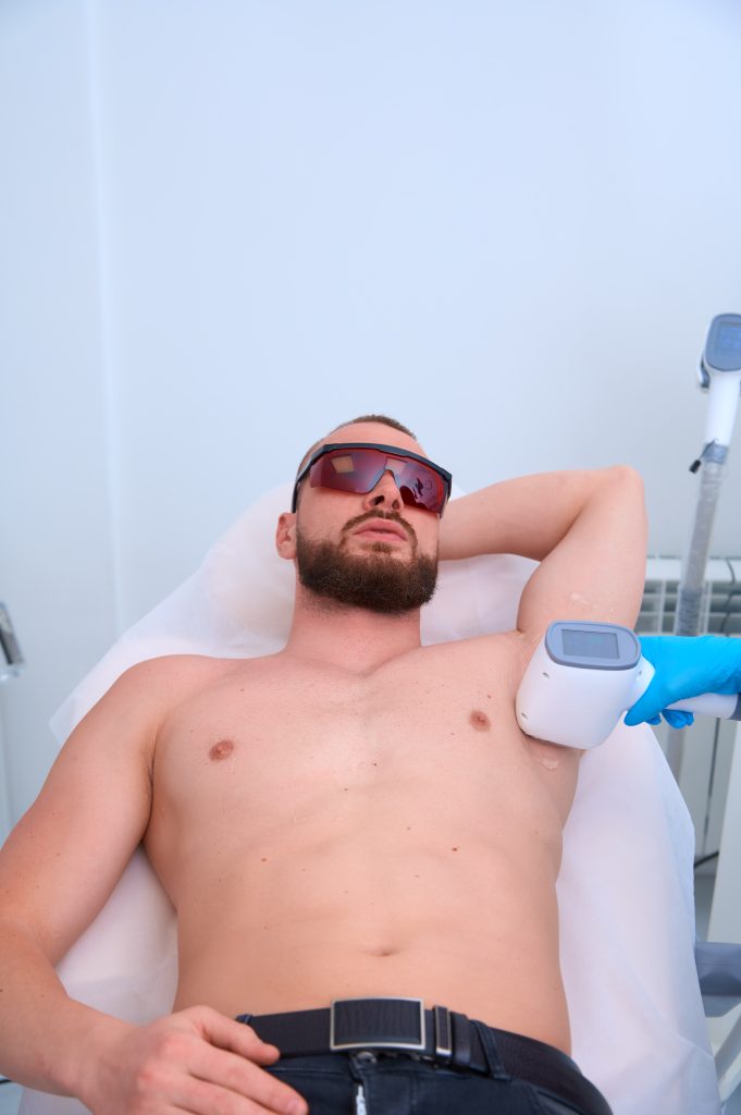 Laser hair removal for men – top-quality service at Abi Beauty