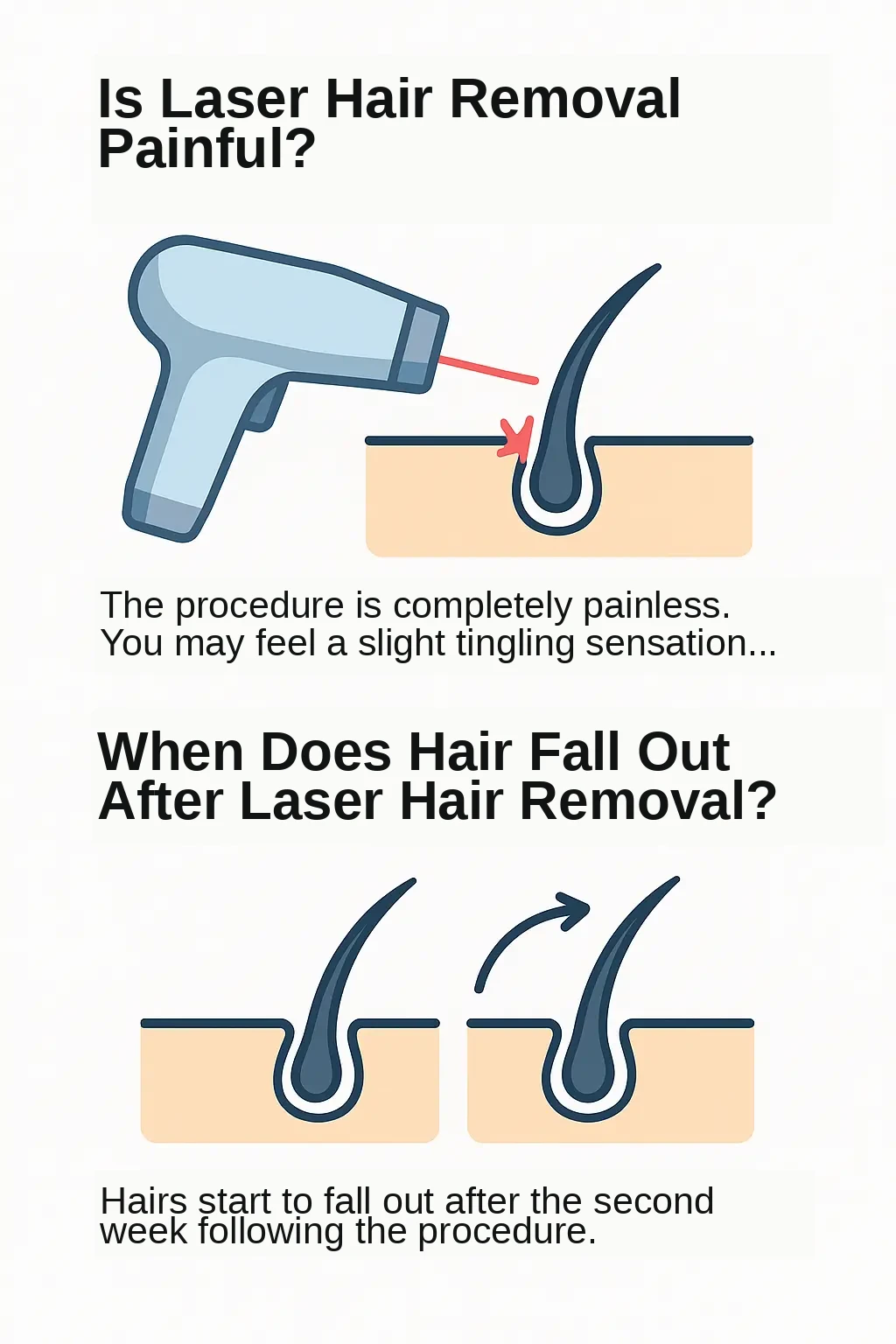 Is laser hair removal painful and when the hair falls out